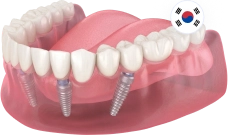 All-on-4 (Все-на-4) Osstem