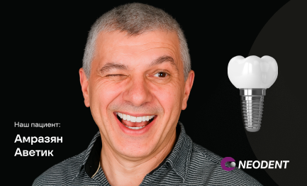 Установка импланта Neodent