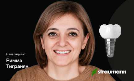 Установка импланта Straumann