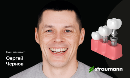 Имплантация Straumann с циркониевой коронкой