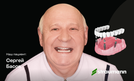 Восстановление всех зубов на 4 имплантах Straumann