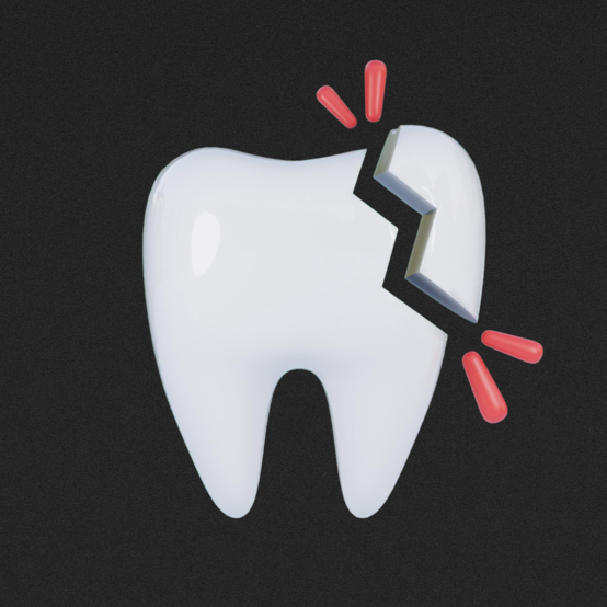 Остался осколок после удаления зуба: что делать