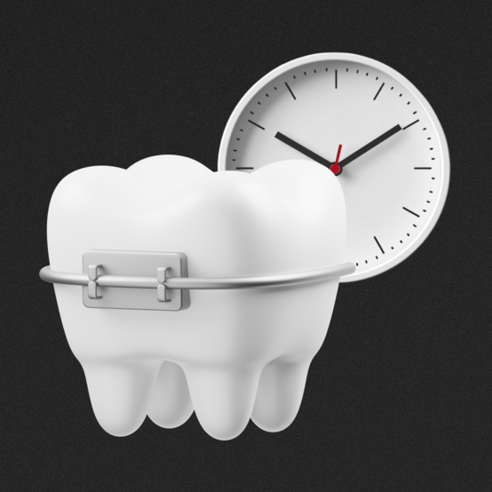 Как привыкнуть к брекетам: сколько длится адаптация