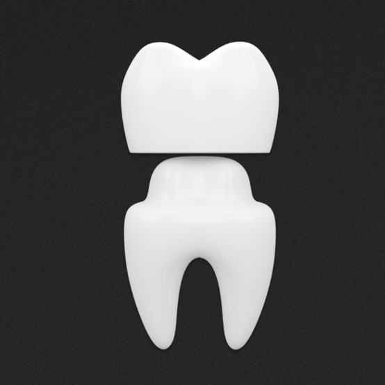Обточка зуба под коронку: как проходит процедура и нужна ли подготовка