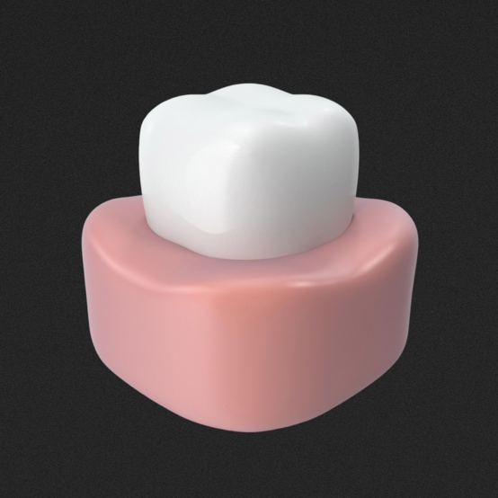 Циркониевая коронка — плюсы и минусы