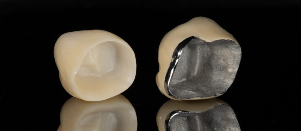 Как снимают коронку с зуба