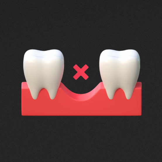 Альвеолит после удаления зуба — как лечить