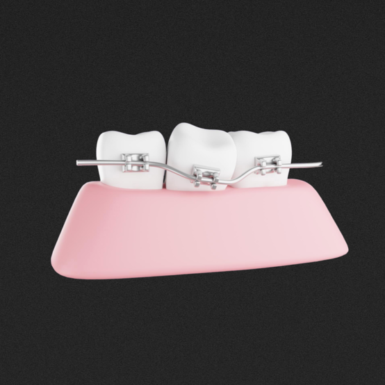 После брекетов зубы болят, шатаются или разъезжаются — что делать