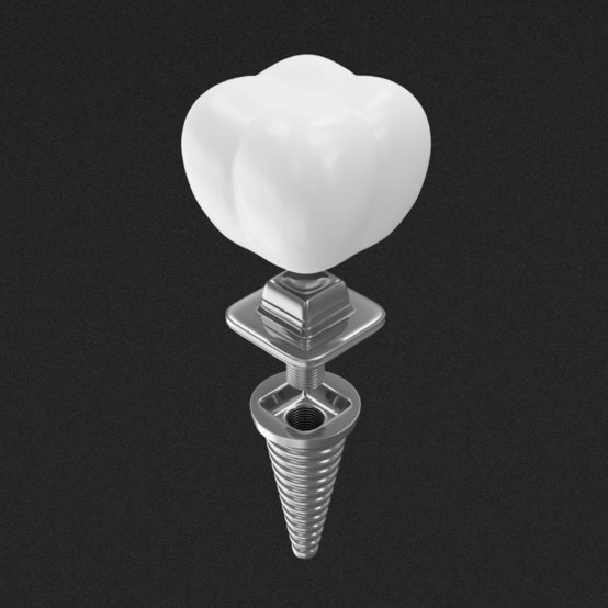 Как проявляется аллергия на импланты зубов