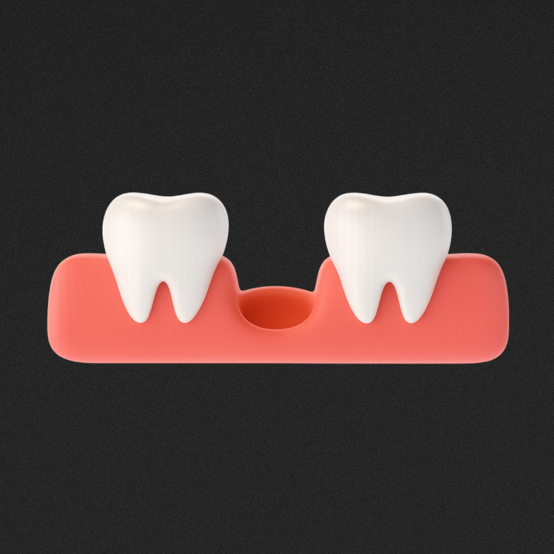 Сколько держится кровяной сгусток после удаления зуба