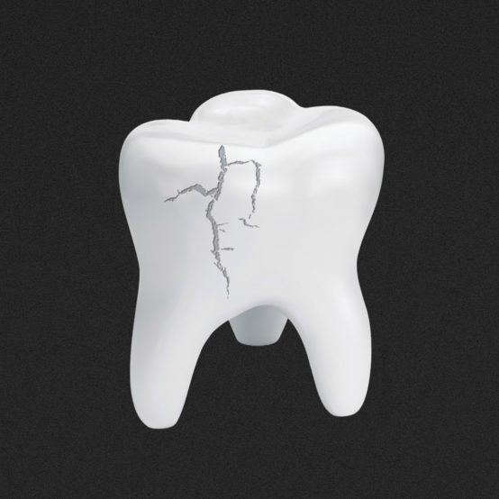 Почему крошатся зубы