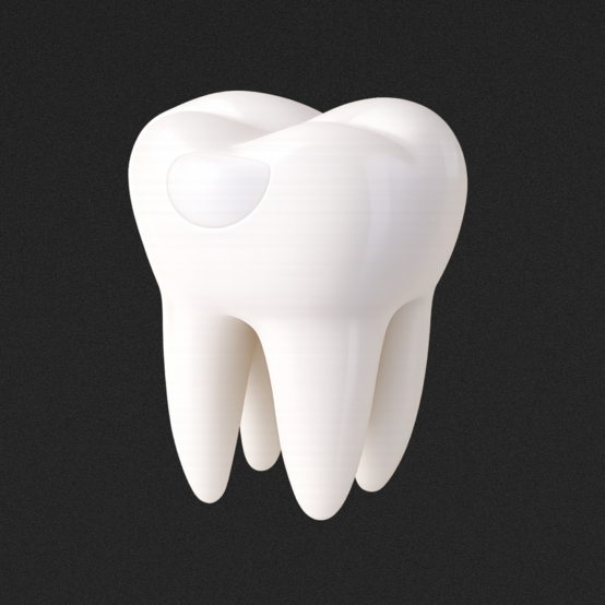 Болит зуб после пломбирования ― что делать