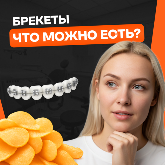 Что можно и нельзя есть с брекетами