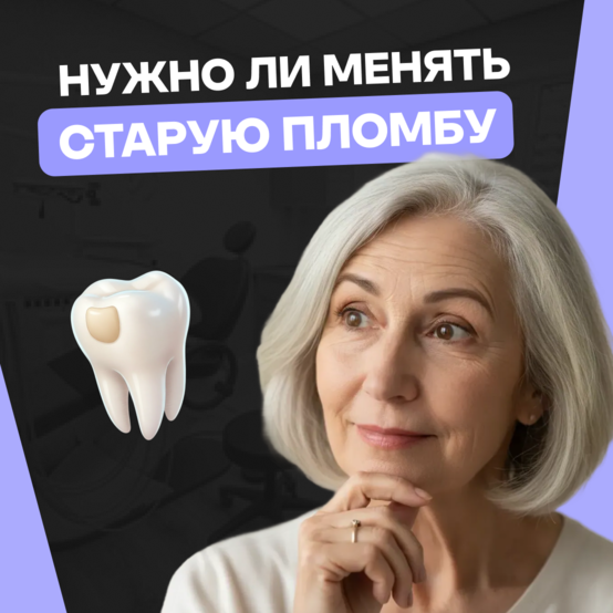 Как часто нужно менять пломбы в зубах
