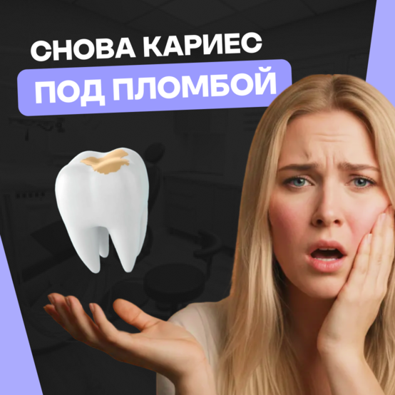 Вторичный кариес под пломбой — как лечить