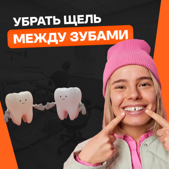 Как убрать щель между зубами