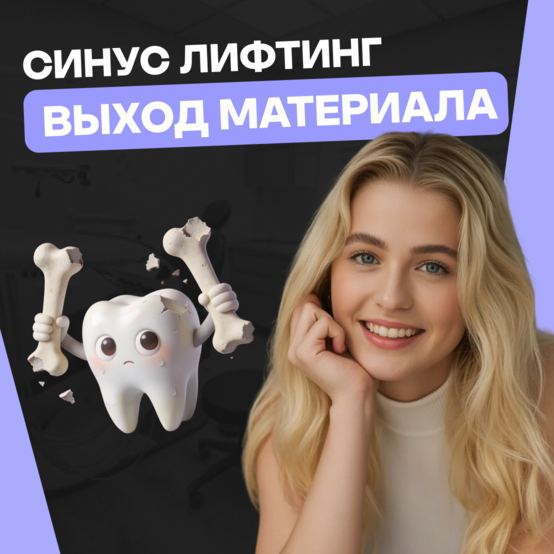 Почему после синус-лифтинга выходит костный материал