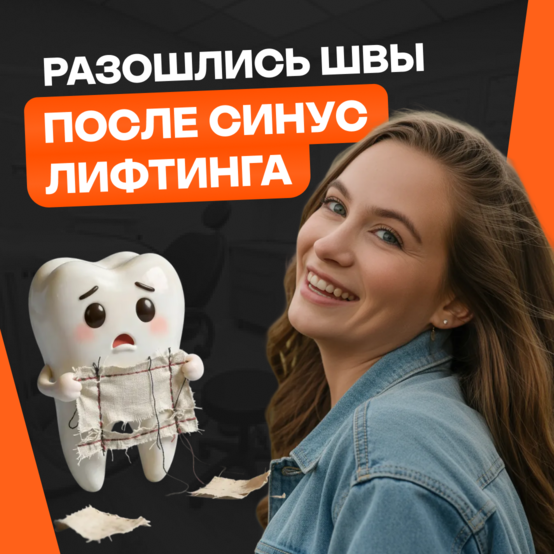 Разошлись швы после синус-лифтинга