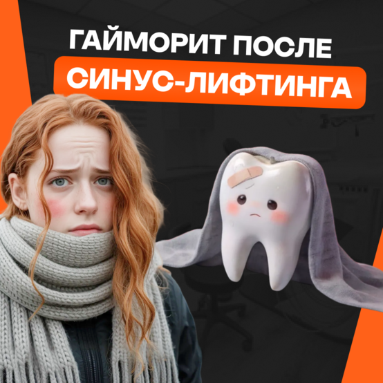 Гайморит после синус-лифтинга