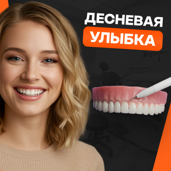 Десневая улыбка
