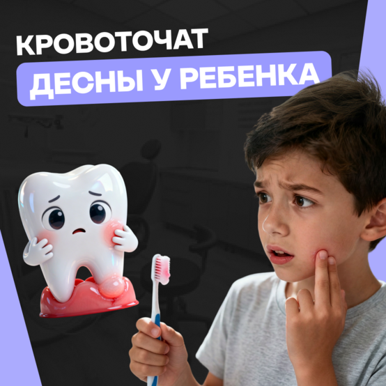 У ребёнка кровоточат дёсны: что делать