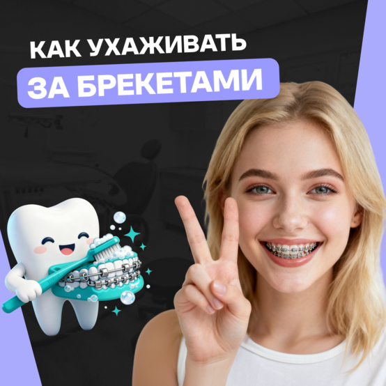Как правильно ухаживать за брекетами и зубами