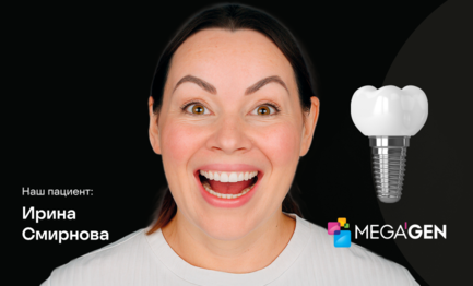 Установка импланта Megagen