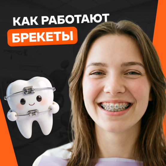 Как работает брекет-система на зубах
