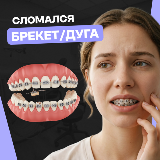Сломался брекет: что делать