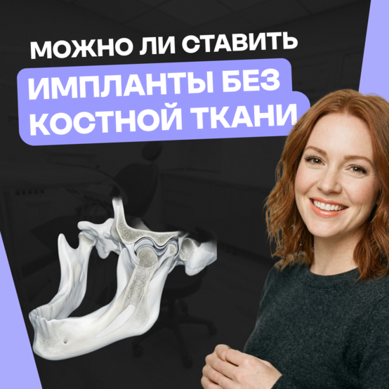 Как поставить имплант, если нет костной ткани