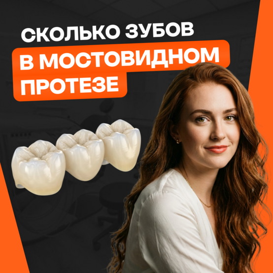 На сколько зубов ставят мостовидный протез