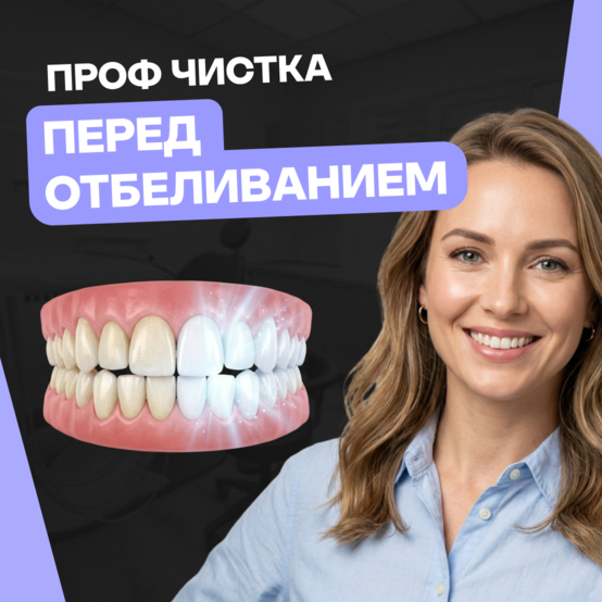 Нужно ли перед отбеливанием делать чистку зубов