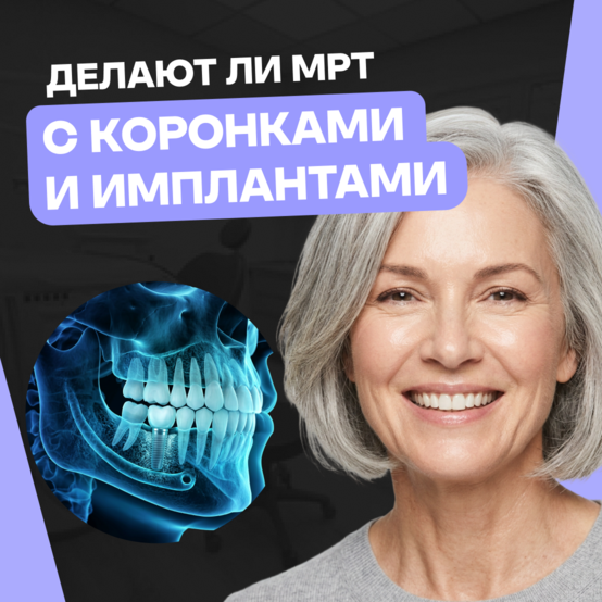 Можно ли делать МРТ с имплантами и коронками