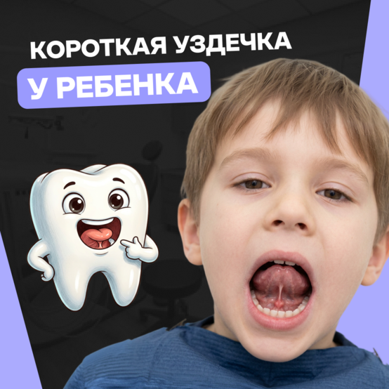 Короткая уздечка языка у ребёнка