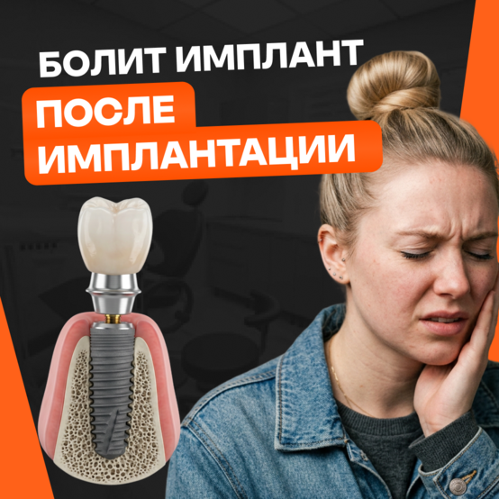 Имплант зуба болит через неделю, месяц или год ― что делать