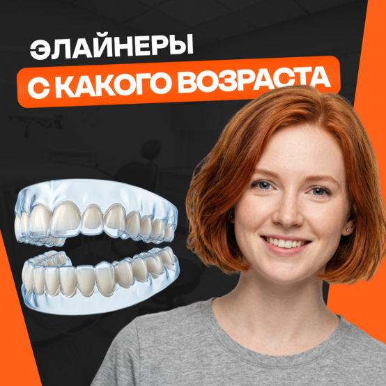 С какого возраста можно ставить элайнеры