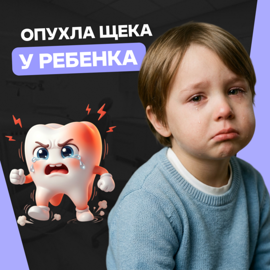 Опухла щека у ребёнка