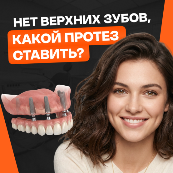Какие протезы лучше поставить, если нет верхних зубов