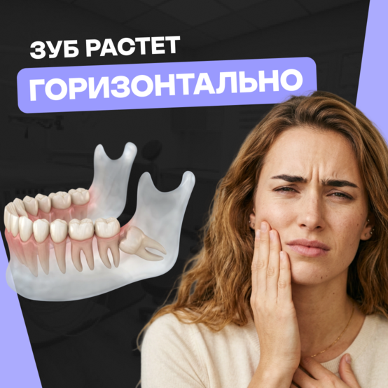Зуб растёт горизонтально: что делать и нужно ли удалять