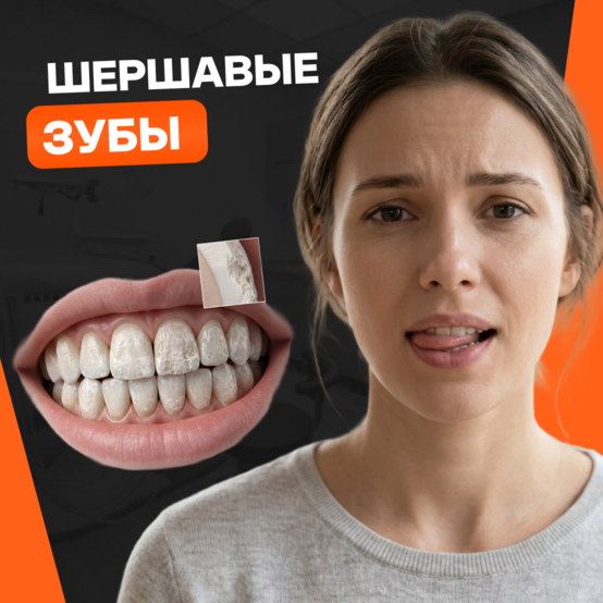 Зубы стали шершавыми: причины, диагностика и лечение