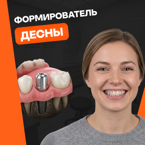 Формирователь десны при имплантации: что это такое