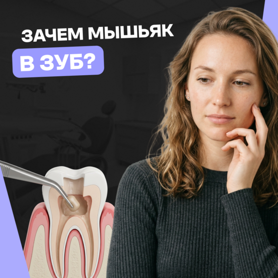 Зачем ставят мышьяк в зуб