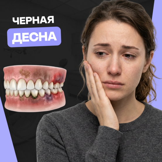 Чёрная десна: почему она потемнела и что делать