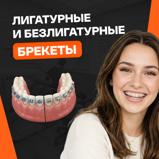 Лигатурные и безлигатурные брекеты: отличия и что лучше