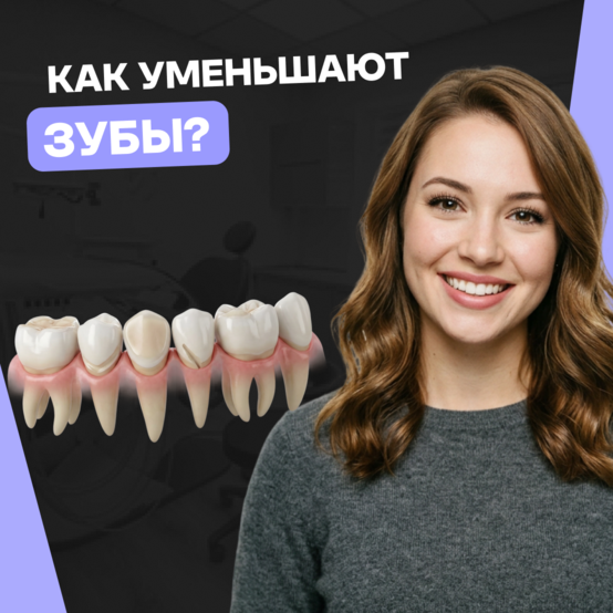 Как уменьшить зубы: какие методы используют в стоматологии