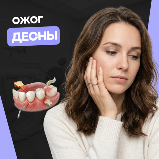 Ожог десны или нёба: чем лечить