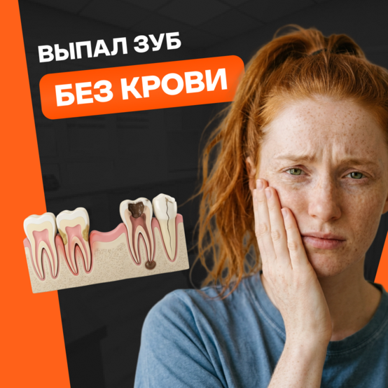 Зубы сами выпадают без боли и крови: что делать