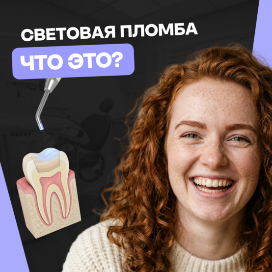Световая пломба: что это такое и чем отличается от обычной