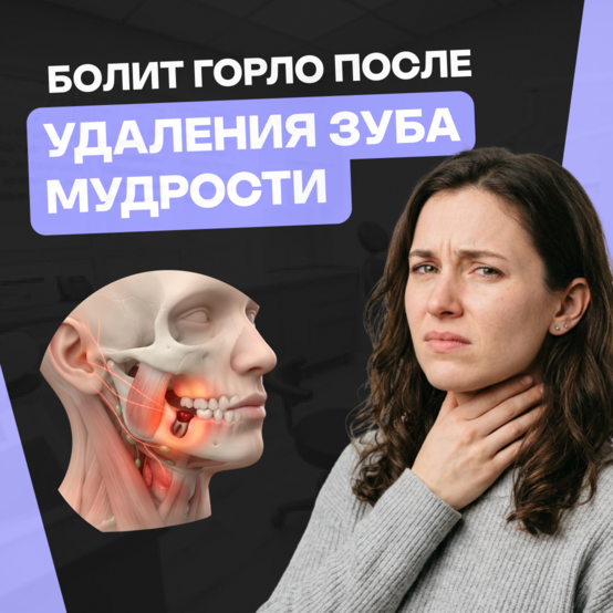 Болит горло после удаления зуба мудрости: норма и осложнения