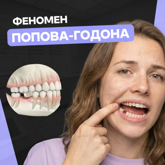 Феномен Попова — Годона в стоматологии